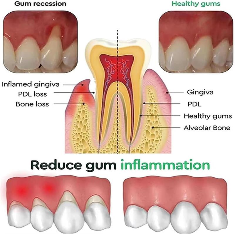 Gel Clareador Dental e Reparad - Teeth Whitening Gels avaliação e preço