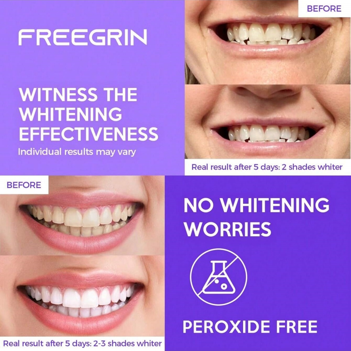 Adesivos de clareamento dental - Teeth Whitening Hydrogen Peroxide avaliação e preço